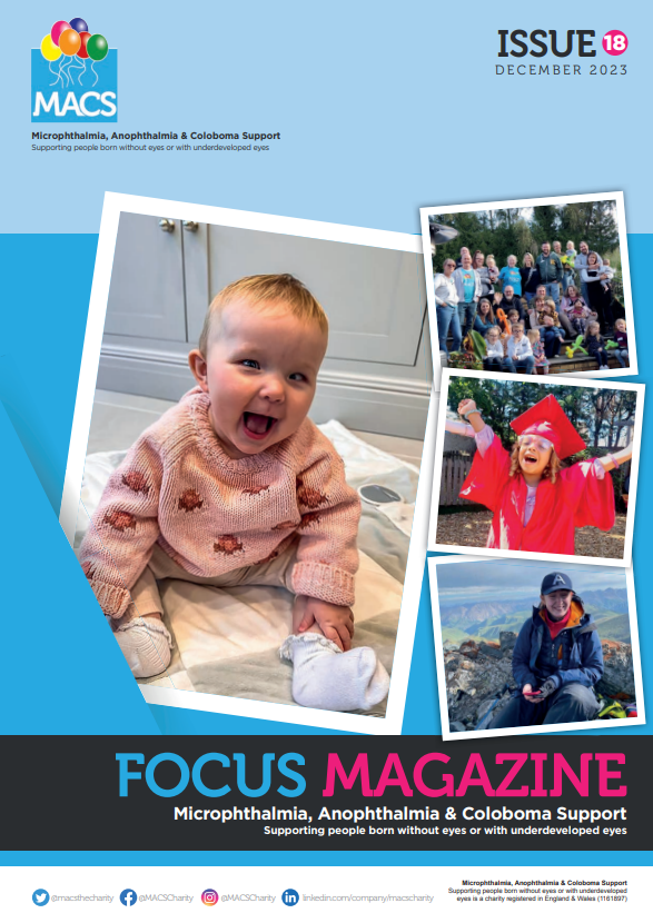 This cover features two Polaroid-style photos arranged at angles. • The larger foreground photo shows a child sitting indoors on a soft surface, wearing a light-colored patterned top. • The smaller collage on the right includes images of individuals outdoors, some wearing blue MACS shirts, and one dressed in a bright red costume with a furry character head. The top includes the MACS logo and “ISSUE 18 Autumn 2019.” The bottom banner presents FOCUS MAGAZINE and the MACS support subtitle.