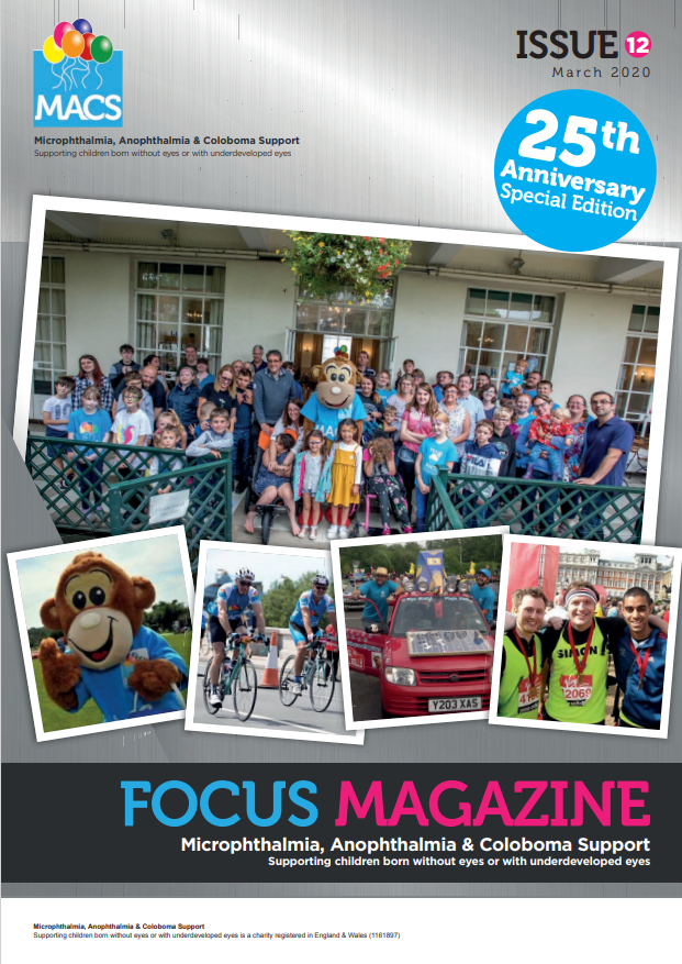 The cover features a group photo taken outside a building with pale walls and tall windows. A large number of people are gathered closely together, many wearing bright blue T‑shirts, creating a coordinated visual effect. Around the main image are three smaller photos arranged like snapshots, showing additional scenes from events or gatherings involving groups of people and mascots. The top left corner contains the MACS logo, and a circular blue badge on the right reads “25th Anniversary Edition.” The bottom banner is dark grey and pink with the title “FOCUS MAGAZINE” and the subtitle “Microphthalmia, Anophthalmia & Coloboma Support.” The top right corner reads “ISSUE 12 2018.”